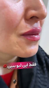 کلینیک زیبایی و لاغری مهشید ذاکری 3