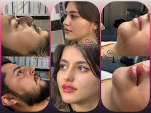 کلینیک لیل 3