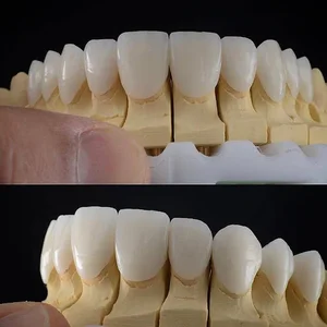 دندانپزشکی زیبایی دکتر رضاعی 2