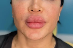 مطب پوست مو زیبایی اسکین ناین 4