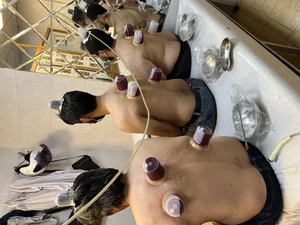حجامت گلبرگ دکتر رضایی فر 5