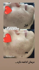 پاکسازی تخصصی پوست