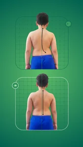 حرکات اصلاحی و آب درمانی مثلث