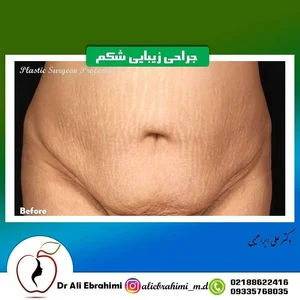 دکتر علی ابراهیمی 3