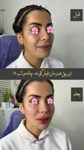 کلینیک زیبایی دکتر مجد 4