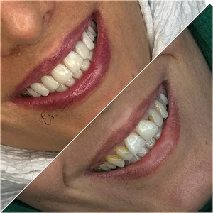 دندانپزشکی دکتر الناز صحافی( ایمپلنت دیجیتال_زیبایی)