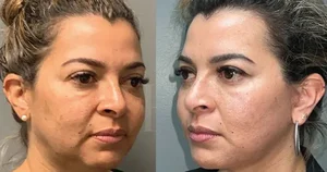 مرکز لیزر و زیبایی لیندا
