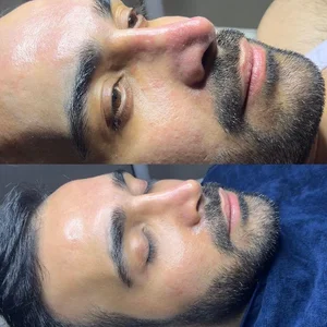 بیوتی تراپیست مژده حقیقت 3