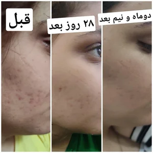خدمات پاکسازی فیشال پوست 5
