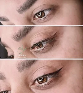 مرکز‌فوق تخصصی ‌میکروبلیدینگ هانی