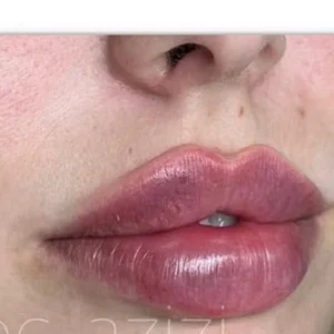 کلینیک زیبایی پریناز