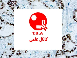 Tashkhis Baft Aaragene.Co.