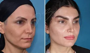 کلینیک زیبایی دکتر شاهین سپه وند