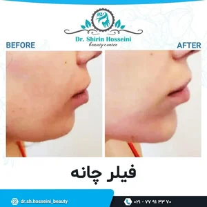 مرکز زیبایی مهرآفرین 2