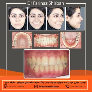 دکتر فریناز شیربان | متخصص ارتودنسی در اصفهان با پرداخت اقساطی