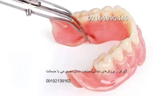 لابراتوار دندانسازی ثامن دندان مصنوعی ژله ای جایگزین ایمپلنت نایتگارد محافظ لثه گیر لثه بند رزمی نایت گارد اوردنچر بیواسطه