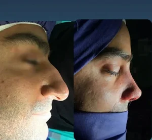 علاج و تجميل في ايران | دانیال طب تور