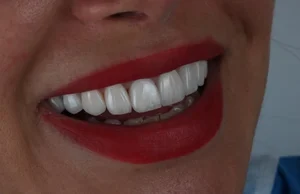 دندانپزشکی دکتر مهرانفرد 3