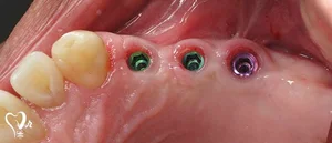 Dental office Dr.Honarparvarمطب دندانپزشکی دکتر مهدی هنرپرور