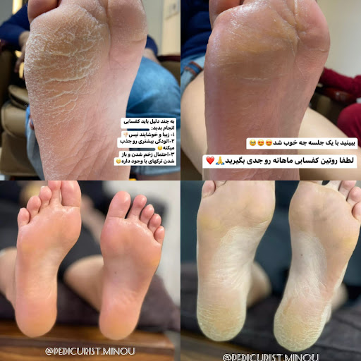 Pedicurist minou
