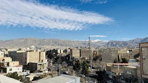 سنجش تراکم استخوان کرج