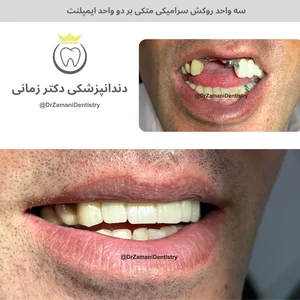 دندانپزشکی دکتر زمانی 5