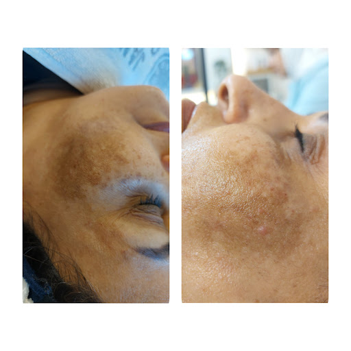 Skin care___fatima.فاطیما احمدی