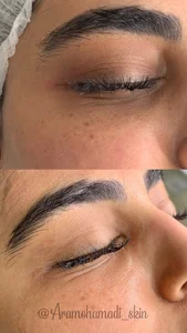 فیشال پوست آرا محمدی (کلینیک زرین) 2