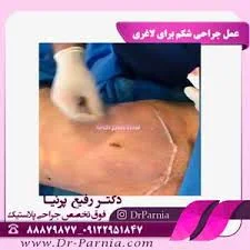 دکتر رضا رفیعی جراح پلاستیک