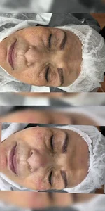 فیشیال و پاکسازی مینو