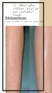 مرکز لیزر مو های زائد کندلا دکتر حجازی 5