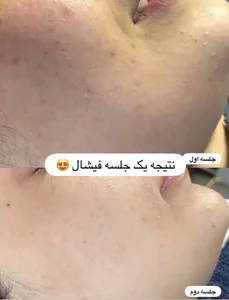 مرکز لیزر ،پوست و زیبایی کندی بیوتی 4