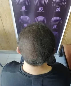 مرکز تخصصی اسکالپ علیرضا بهشتی