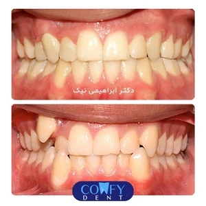 دکتر زهرا ابراهیمی نیک متخصص ارتودنسی و ناهنجاریهای فک و صورت 5