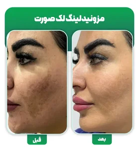 فیشیال
