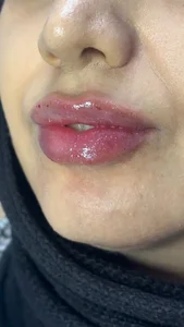کلینیک پوست،زیبایی و لیزرماریسا 2