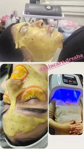 فیشیال و پاکسازی عاطفی