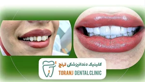 کلینیک دندانپزشکی ترنج 5