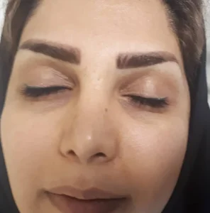 فیشیال و پاکسازی صورت مژگان 2