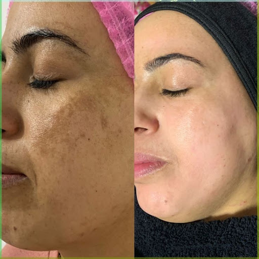 کلینیک زیبایی مه‌نگار