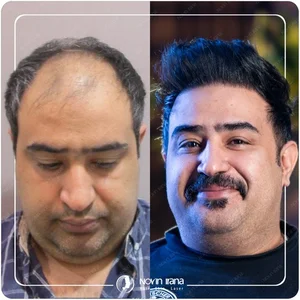 Keratin shadi