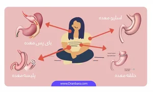اسلیومعده جراح چاقی دکتر محمد یرانی